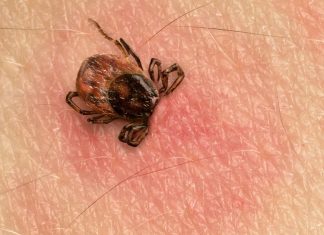 Explosion de cas de la maladie de Lyme Explosion de cas de la maladie de Lyme