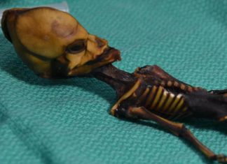 Le squelette d’Atacama n’est pas un extraterrestre, mais une petite fille
