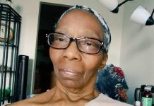 Une Américaine comprend qu’elle fait un AVC grâce à un selfie Une Américaine comprend qu'elle fait un AVC grâce à un selfie
