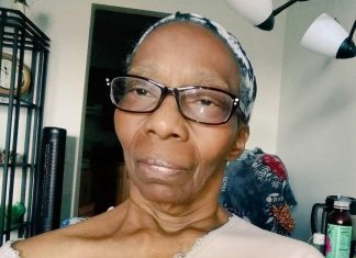 Une Américaine comprend qu’elle fait un AVC grâce à un selfie Une Américaine comprend qu'elle fait un AVC grâce à un selfie