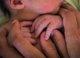 Agnès Buzyn enquête sur les bébés nés sans bras Agnès Buzyn enquête sur les bébés nés sans bras