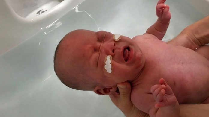 Japon: Un Bébé Né prématuré à 268g, il quitte la maternité en bonne santé