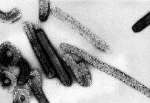 Virus Borna en Allemagne: huit personnes décédées entre 1999 et 2019 Virus Borna en Allemagne: huit personnes décédées entre 1999 et 2019