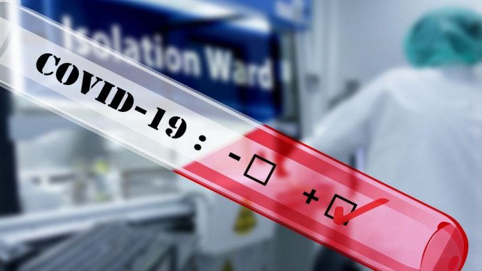 Actualités Coronavirus : 79 décès et 3.661 cas de coronavirus