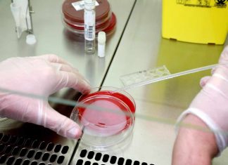 Étude américaine : La chloroquine ne montre aucun signe d’efficacité contre le Covid-19 Étude américaine : La chloroquine ne montre aucun signe d'efficacité contre le Covid-19