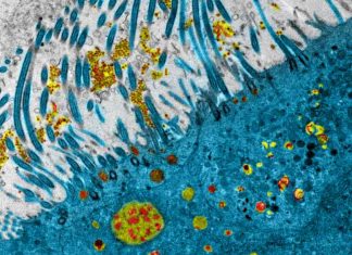 Coronavirus : des médicaments testés à Lyon donnent des résultats très positifs Coronavirus : des médicaments testés à Lyon donnent des résultats très positifs