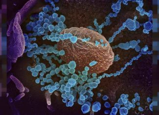 Coronavirus : La France pourrait connaître une nouvelle flambée de cas de Covid-19 à la mi-mars, selon une étude Coronavirus : La France pourrait connaître une nouvelle flambée de cas de Covid-19 à la mi-mars, selon une étude