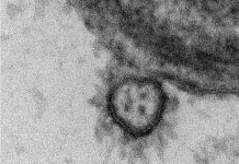 Coronavirus: Résultats de l’étude translationnelle Explore Covid-19 Coronavirus: Résultats de l’étude translationnelle Explore Covid-19