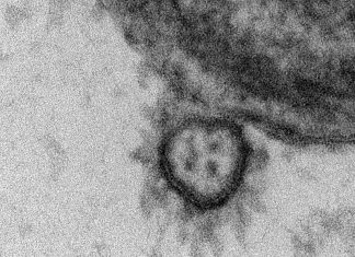 Coronavirus: Résultats de l’étude translationnelle Explore Covid-19 Coronavirus: Résultats de l’étude translationnelle Explore Covid-19