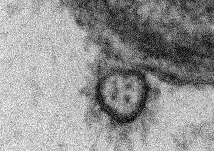 Coronavirus: Résultats de l’étude translationnelle Explore Covid-19