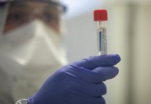 Coronavirus France en direct : Plus de 16.000 nouveaux cas en 24 heuresa Direct – Chiffres Covid : Bilan en France, Samedi 27 Février 2021