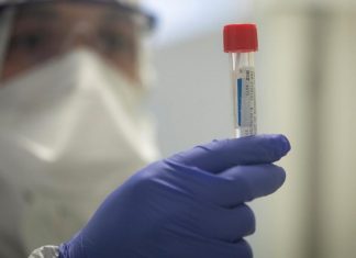 Direct – Chiffres Covid : Bilan en France, Samedi 27 Février 2021 Direct – Chiffres Covid : Bilan en France, Samedi 27 Février 2021