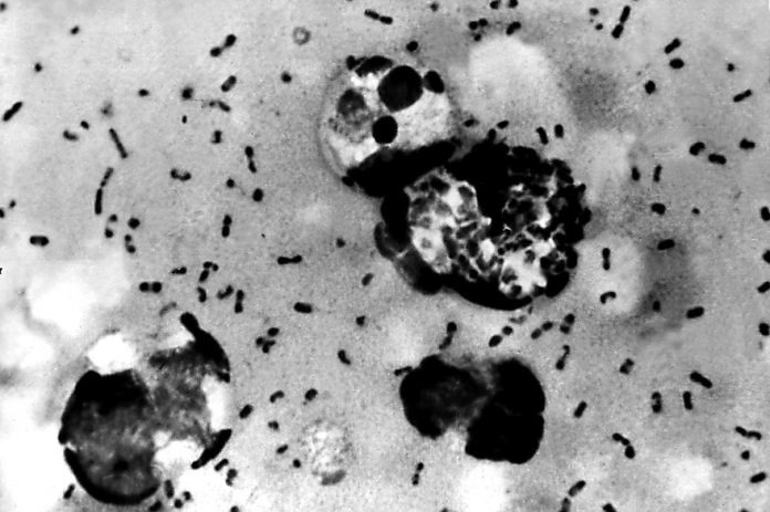 En Chine, un village bouclé à cause de la peste (détail)