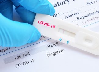 Coronavirus France : attention à la fiabilité des tests antigéniques Direct – Chiffres Covid : Bilan en France, Lundi 25 janvier 2021