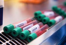 Coronavirus: le cri d’alerte de plusieurs chercheurs (détail) Direct – Chiffres Covid : Bilan en France, Lundi 1 Mars 2021