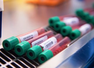 Coronavirus: le cri d’alerte de plusieurs chercheurs (détail) Direct – Chiffres Covid : Bilan en France, Lundi 1 Mars 2021