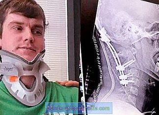 A 22 ans, il survit miraculeusement à une « décapitation interne » (VIDEO) A 22 ans, il survit miraculeusement à une "décapitation interne"