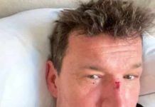 Benjamin Castaldi blessé au visage : que s’est-il passé ? (PHOTO) Benjamin Castaldi blessé au visage : que s'est-il passé ? (PHOTO)