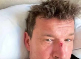 Benjamin Castaldi blessé au visage : que s’est-il passé ? (PHOTO) Benjamin Castaldi blessé au visage : que s'est-il passé ? (PHOTO)