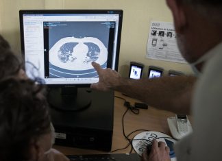 Une femme meurt après une transplantation de poumons infectés par le Covid-19 (détail) Une femme meurt après une transplantation de poumons infectés par le Covid-19 (détail)