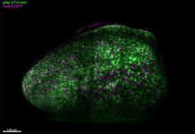 Lumière sur la coordination de l’activation des cellules souches neurales (étude) Lumière sur la coordination de l'activation des cellules souches neurales (étude)