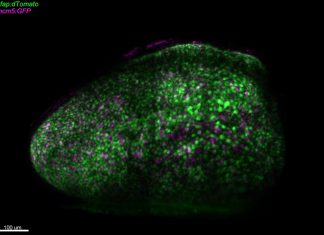 Lumière sur la coordination de l’activation des cellules souches neurales (étude) Lumière sur la coordination de l'activation des cellules souches neurales (étude)