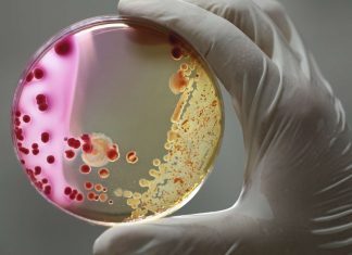 Bactérie Escherichia coli : les autorités sanitaires insistent sur la prévention Bactérie Escherichia coli : les autorités sanitaires insistent sur la prévention