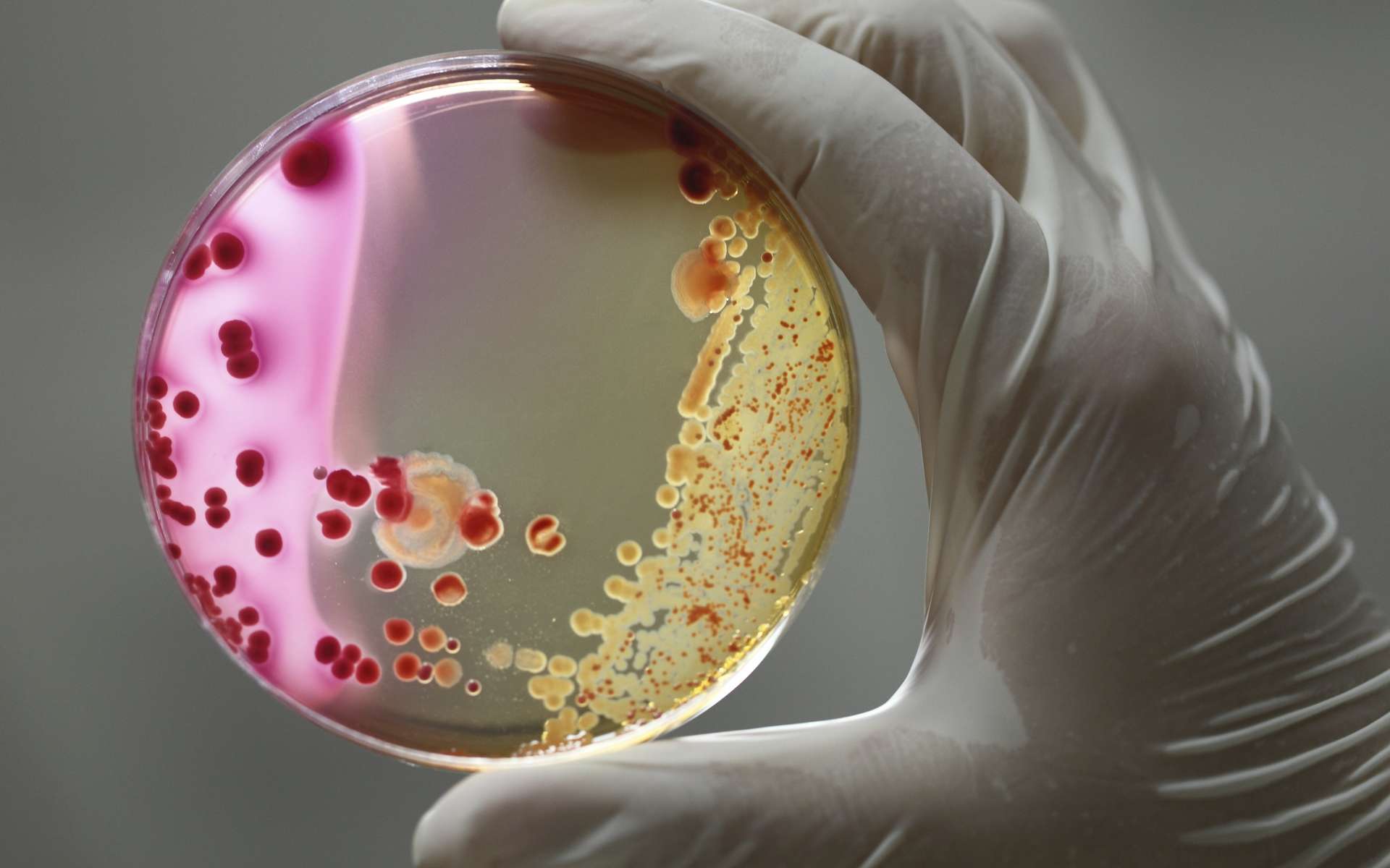 Bactérie Escherichia coli : les autorités sanitaires insistent sur la prévention