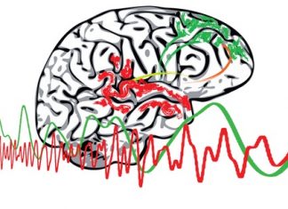 Étude : Un défaut de communication lors de troubles psychotiques Étude : Un défaut de communication lors de troubles psychotiques