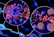 Étude : Une protéine trop efficace favorise l’alzheimer Étude : Une protéine trop efficace favorise l’alzheimer