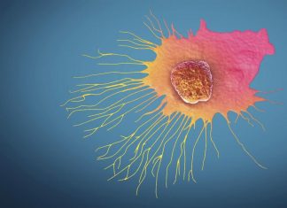 L’Université de Genève dévoile les origines des métastases L’Université de Genève dévoile les origines des métastases