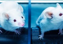 Maladie de Parkinson : Un gène pourrait prévenir la dégénérescence Maladie de Parkinson : Un gène pourrait prévenir la dégénérescence