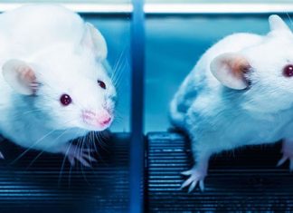 Maladie de Parkinson : Un gène pourrait prévenir la dégénérescence Maladie de Parkinson : Un gène pourrait prévenir la dégénérescence