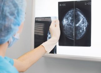 Première mondiale: un médicament découvert pour prévenir les récidives et métastases du cancer du sein Première mondiale: un médicament découvert pour prévenir les récidives et métastases du cancer du sein