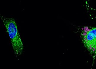 Santé : Le rôle des lipides dans l’apparition de la maladie d’Alzheimer Santé : Le rôle des lipides dans l’apparition de la maladie d’Alzheimer