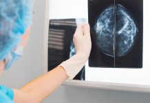Une adolescente de 12 ans emportée par un cancer du sein Une adolescente de 12 ans emportée par un cancer du sein