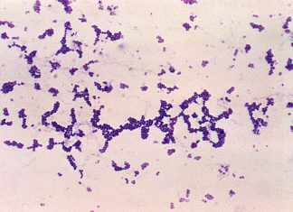 Infections à la bactérie streptocoque A : que sont ces bactéries qui inquiètent la France? Infections à la bactérie streptocoque A : que sont ces bactéries qui inquiètent la France?