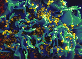 Découverte révolutionnaire : les protéines clés dans la latence du VIH révélées Découverte révolutionnaire : les protéines clés dans la latence du VIH révélées