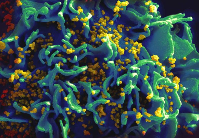Découverte révolutionnaire : les protéines clés dans la latence du VIH révélées