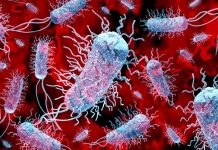 L’alerte de l’OMS sur Klebsiella pneumoniae : une menace croissante Alerte: une "superbactérie” mortelle se propage dans le monde entier