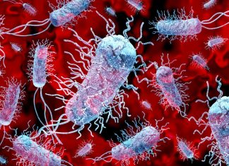 L’alerte de l’OMS sur Klebsiella pneumoniae : une menace croissante Alerte: une "superbactérie” mortelle se propage dans le monde entier